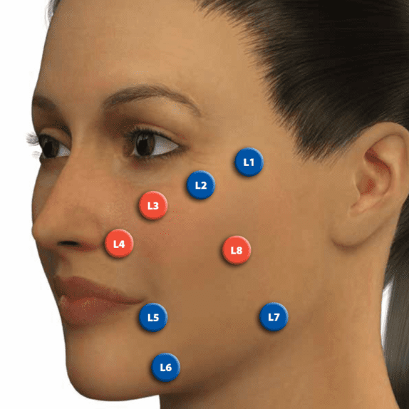 The MD-Codes™ 8-point Lift