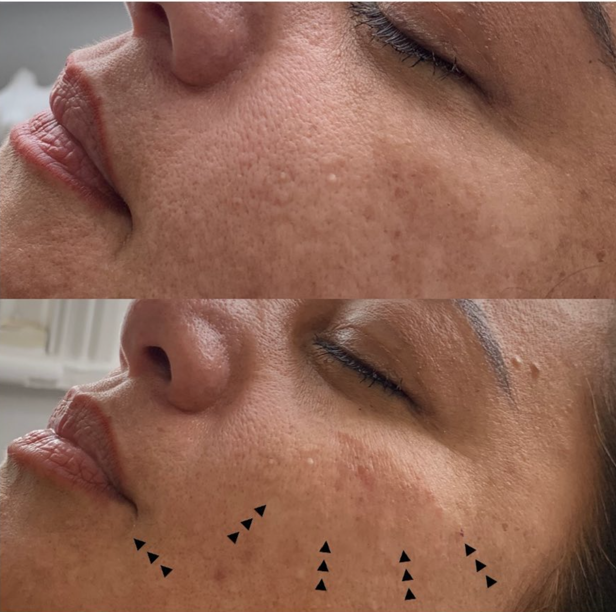 Cc2