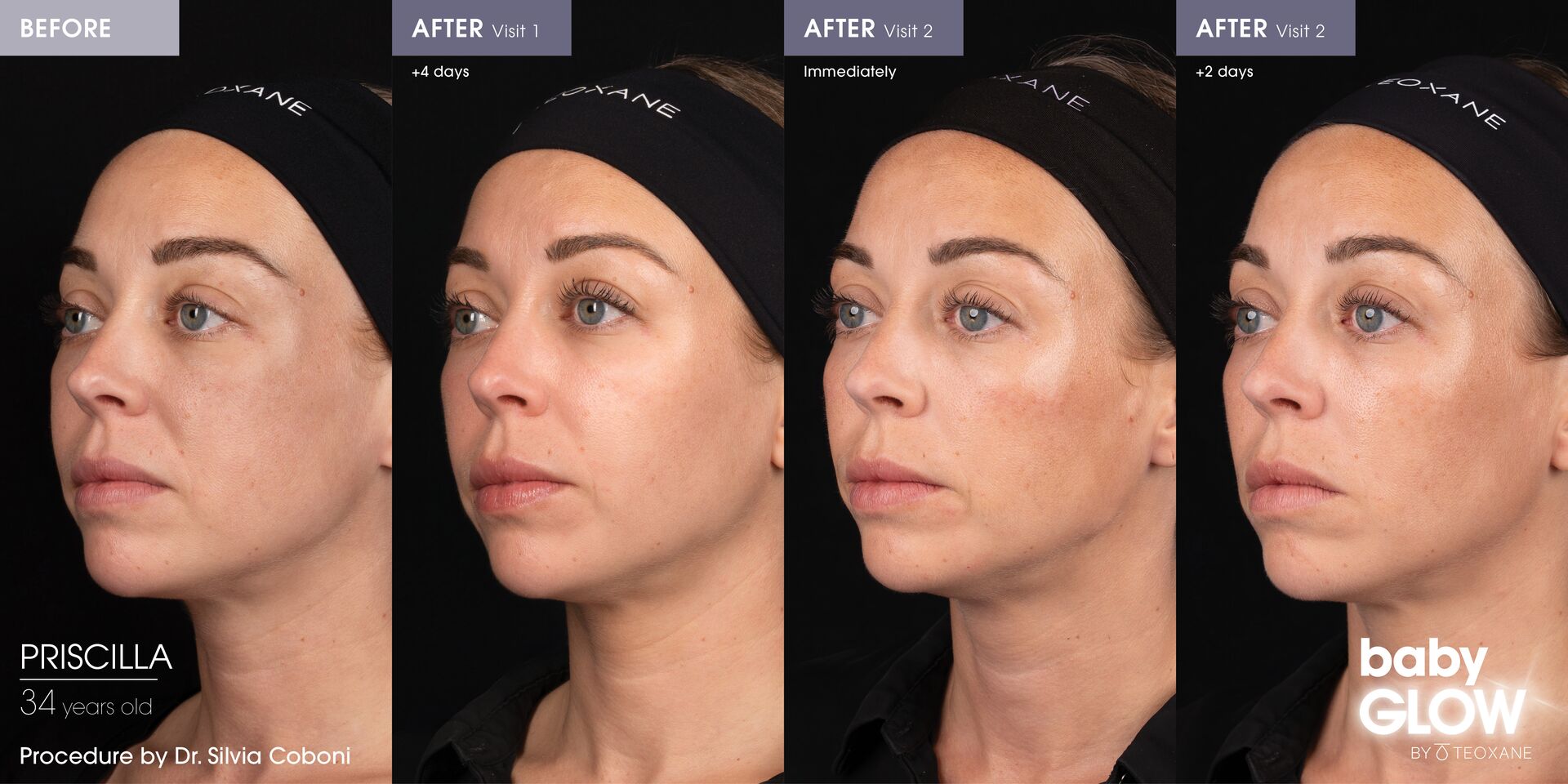Social B&A COMBI