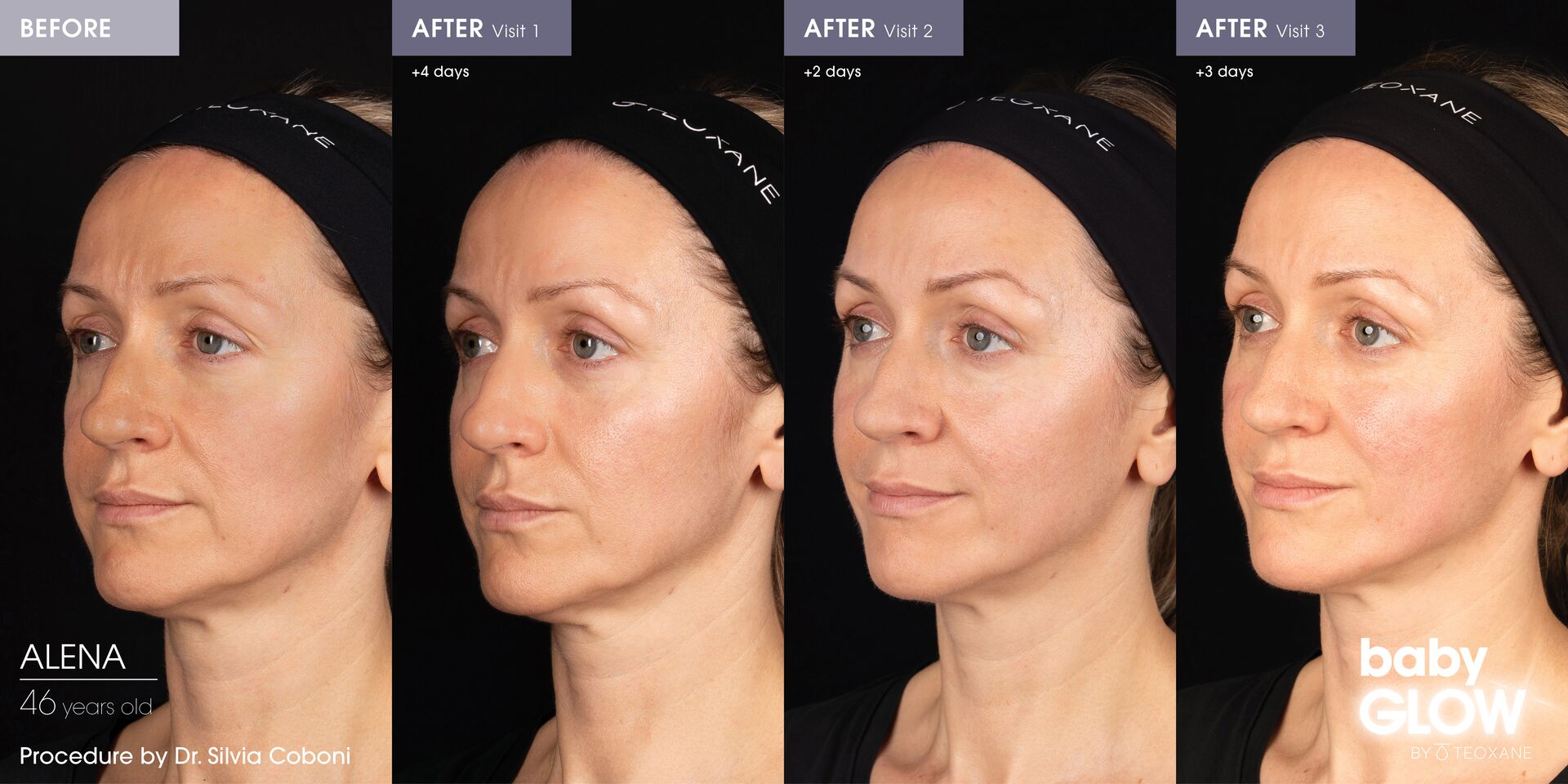 Social B&A COMBI2